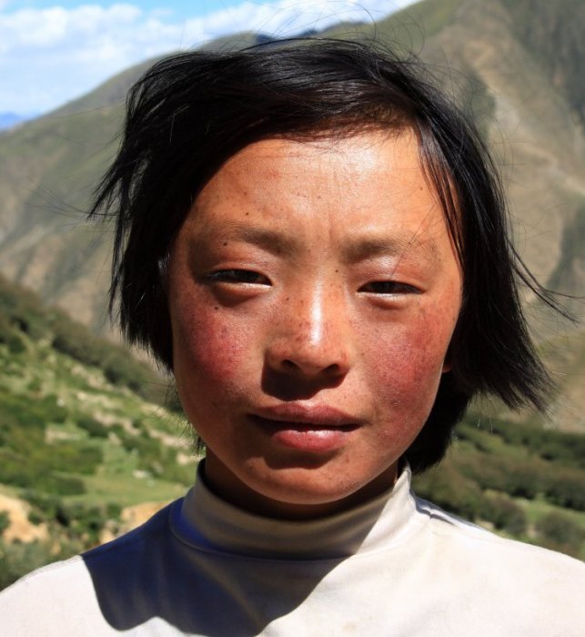 {short description of image}